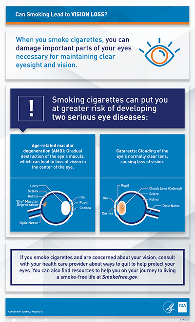 This 8.5” x 14” infographic provides information about how quitting smoking can improve eye health.