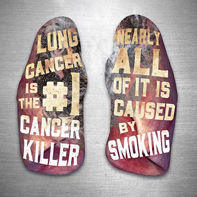 The facts about lung cancer and smoking couldn’t be clearer. #Smoking #Cigarettes #Cigs