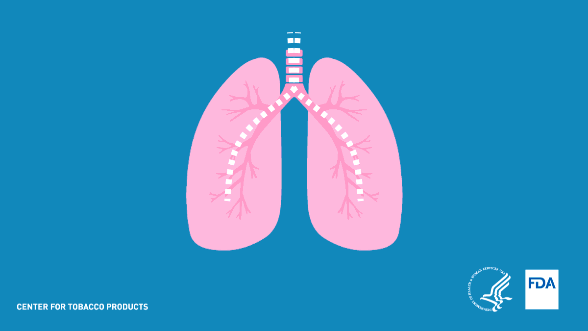 More than 8 out of 10 lung cancer deaths in the U.S. can be attributed to smoking. Learn more about how smoking can affect your lungs: https://go.usa.gov/xzzXv via @FDATobacco.
